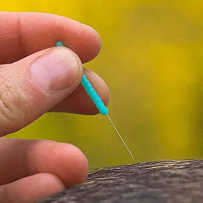 Acupuncture